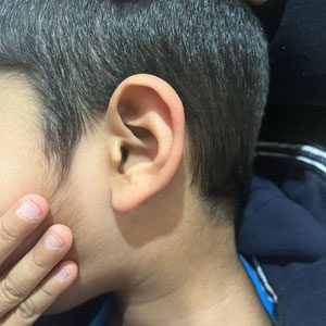 kids ear wax removal